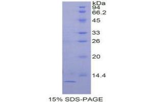 SDS-PAGE analysis of Human TGFa Protein.