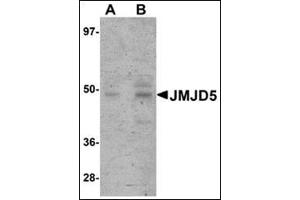 Western blot analysis of JMJD5 in human liver tissue lysate with this product at (A) 1 and (B) 2 μg/ml. (JMJD5 anticorps  (C-Term))