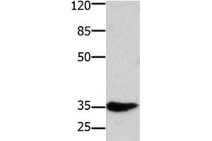 Western Blot analysis of Mouse muscle tissue using HOXA11 Polyclonal Antibody at dilution of 1:350 (Homeobox A11 anticorps)