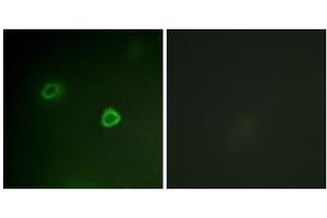 Immunofluorescence analysis of COS7 cells, using p90 RSK (Phospho-Thr573) antibody. (RPS6KA3 anticorps  (pThr573))