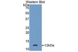 Western Blotting (WB) image for anti-S100 Calcium Binding Protein P (S100P) (AA 1-95) antibody (ABIN3205546) (S100P anticorps  (AA 1-95))