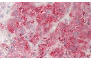 anti-Neuropilin 1 (NRP1) (AA 646-814) antibody