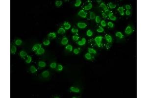 Immunofluorescence staining of Hela cells (treated with 30mM sodium butyrate for 4h) with ABIN7139151 at 1:2.