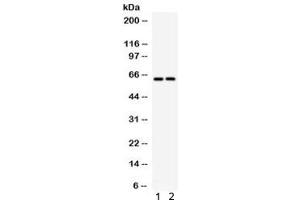 Western blot testing of 1) rat brain and 2) mouse brain lysate with SLC22A2 antibody. (SLC22A2 anticorps)