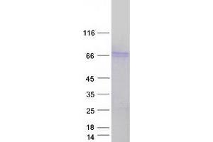 Validation with Western Blot
