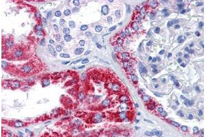 anti-OCIA Domain Containing 2 (OCIAD2) (C-Term) antibody