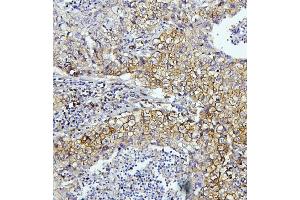 IHC analysis of EIF4A using anti-EIF4A antibody (ABIN7601309). (EIF4A1 anticorps  (AA 32-406))