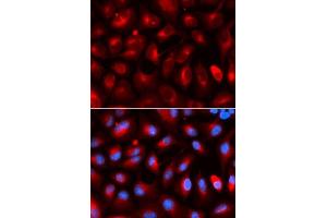 Immunofluorescence analysis of U2OS cells using KLC1 antibody.