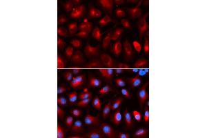 Immunofluorescence analysis of U2OS cells using KLC1 antibody. (KLC1 anticorps  (AA 261-560))