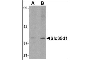 Western blot analysis of Slc35D1 inA-20 lysate with this product at (A) 1 and (B) 2 μg/ml.