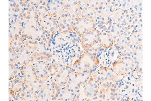 ABIN6267224 at 1/100 staining rat kidney tissue sections by IHC-P. (CHEK1 anticorps  (pSer317))