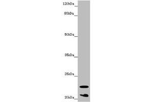 Western blot All lanes: CRYGS antibody at 6. (CRYGS anticorps  (AA 1-178))