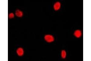 Immunofluorescent analysis of CBP20 staining in Hela cells. (NCBP2 anticorps  (N-Term))