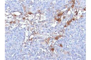 Image no. 3 for anti-Melanoma Cell Adhesion Molecule (MCAM) antibody (ABIN6153528) (MCAM anticorps)