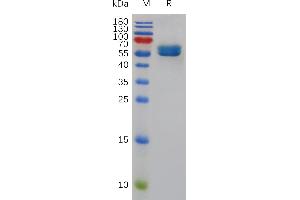 Mouse SL Protein, hFc Tag on SDS-PAGE under reducing condition.