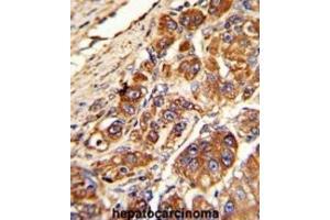 Immunohistochemistry (IHC) image for anti-Kinesin Light Chain 1 (KLC1) antibody (ABIN3003845)