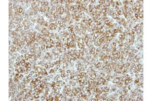 IHC-P Image Immunohistochemical analysis of paraffin-embedded BT483 xenograft, using eEF-2K, antibody at 1:500 dilution.