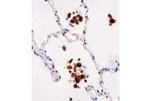 Paraformaldehyde-fixed, paraffin embedded Human lungtissue, Antigen retrieval by boiling in sodium citrate buffer (pH6.