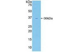 Detection of Recombinant IL22R, Human using Polyclonal Antibody to Interleukin 22 Receptor (IL22R) (IL22R anticorps  (AA 267-565))