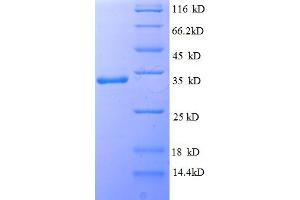 SDS-PAGE (SDS) image for Interleukin 1 Family, Member 10 (Theta) (IL1F10) (AA 1-152), (full length) protein (His-SUMO Tag) (ABIN5711577)