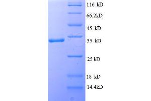 SDS-PAGE (SDS) image for Interleukin 1 Family, Member 10 (Theta) (IL1F10) (AA 1-152), (full length) protein (His-SUMO Tag) (ABIN5711577) (IL1F10 Protein (AA 1-152, full length) (His-SUMO Tag))