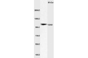 Rat Brain lysates probed with Rabbit Anti-ApoER2 Polyclonal Antibody (ABIN719426) at 1:200 in 4 °C. (LRP8 anticorps  (AA 851-963))