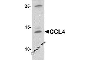 Western Blotting (WB) image for anti-Chemokine (C-C Motif) Ligand 4 (CCL4) antibody (ABIN1077439)