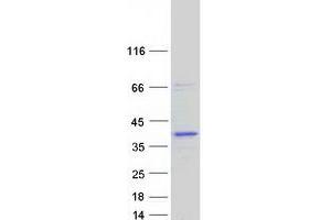 Validation with Western Blot