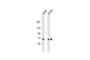 Western Blot at 1:1000 dilution Lane 1: A549 whole cell lysate Lane 2: Jurkat whole cell lysate Lysates/proteins at 20 ug per lane. (Factor XI anticorps  (AA 281-307))