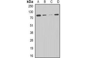 Western blot analysis of CPT2 expression in HepG2 (A), THP1 (B), mouse liver (C), mouse heart (D) whole cell lysates. (CPT2 anticorps)