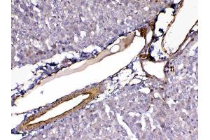 IHC analysis of VEGF Receptor 3 using anti-VEGF Receptor 3 antibody .