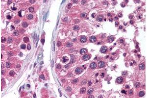 Human Testis (formalin-fixed, paraffin-embedded) stained with TEGT antibody ABIN290214 at 5 ug/ml followed by biotinylated anti-mouse IgG secondary antibody ABIN481714, alkaline phosphatase-streptavidin and chromogen. (Bax Inhibitor 1 anticorps)