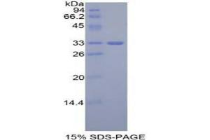 SDS-PAGE analysis of Mouse GLI3 Protein. (GLI Family Zinc Finger Protein 3 Protéine)