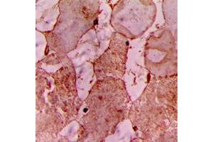 Immunohistochemical analysis of CARK staining in human heart formalin fixed paraffin embedded tissue section. (TNNI3K anticorps  (Center))