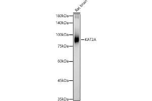 Western blot analysis of extracts of Rat brain, using KA antibody (ABIN1679964, ABIN5664011, ABIN5664013 and ABIN6219456) at 1:462 dilution.