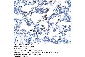Human Lung (E2F6 anticorps  (Middle Region))