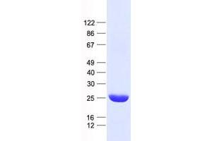 Validation with Western Blot