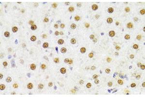 Immunohistochemistry of paraffin-embedded Rat liver using HDGF Polyclonal Antibody at dilution of 1:100 (40x lens). (HDGF anticorps)