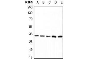 Western blot analysis of PPP2CA (pY307) expression in HEK293T EGF-treated (A), MCF7 (B), mouse brain (C), NIH3T3 (D), H9C2 EGF-treated (E) whole cell lysates. (PPP2CA anticorps  (C-Term, pTyr307))