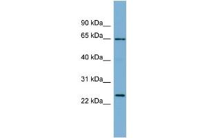 WB Suggested Anti-HOM-TES-103  Antibody Titration: 0. (IFFO1 anticorps  (N-Term))