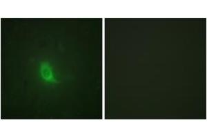 Immunofluorescence analysis of HuvEc cells, using SEPARASE (Phospho-Ser801) Antibody. (Separase anticorps  (pSer801))