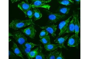 IF analysis of Caveolin-2/CAV2 using anti-Caveolin-2/CAV2 antibody (ABIN7601170). (Caveolin 2 anticorps  (AA 3-162))