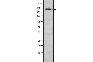 Western blot analysis of MYH11 using LOVO whole cell lysates (MYH11 anticorps  (C-Term))