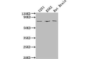 Western Blot Positive WB detected in: U251 whole cell lysate, K562 whole cell lysate, Rat Brain tissue All lanes: SGO1 antibody at 1:2000 Secondary Goat polyclonal to rabbit IgG at 1/50000 dilution Predicted band size: 65, 36, 34, 32, 30, 61, 25 kDa Observed band size: 65 kDa (Shugoshin anticorps  (AA 260-439))