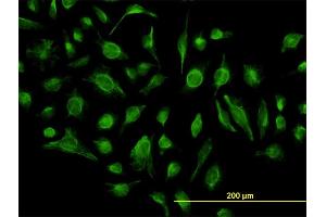 Immunofluorescence of monoclonal antibody to GABBR1 on HeLa cell.