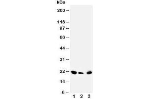 Western blot testing of DUSP3 antibody and Lane 1:  rat testis;  2: human SKOV;  3: (h) MM453 cell lysate (Dual Specificity Phosphatase 3 (DUSP3) (C-Term) anticorps)