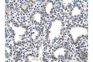 PPIB antibody was used for immunohistochemistry at a concentration of 4-8 ug/ml to stain Alveolar cells (arrows) in Human Lung.