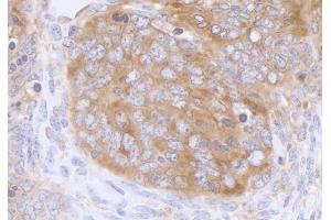 Immunohistochemistry (IHC) image for anti-Eukaryotic Translation Initiation Factor 3 Subunit A (EIF3A) (AA 860-910) antibody (ABIN7453842) (EIF3A anticorps  (AA 860-910))