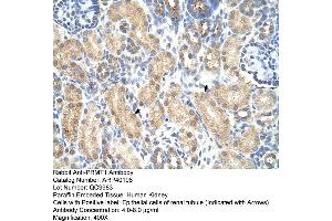 Rabbit Anti-PRMT1 Antibody  Paraffin Embedded Tissue: Human Kidney Cellular Data: Epithelial cells of renal tubule Antibody Concentration: 4. (PRMT1 anticorps  (Middle Region))
