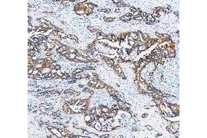 IHC analysis of Cytokeratin 20/Krt20 using anti-Cytokeratin 20/Krt20 antibody (ABIN7601133). (KRT20 anticorps  (AA 29-431))